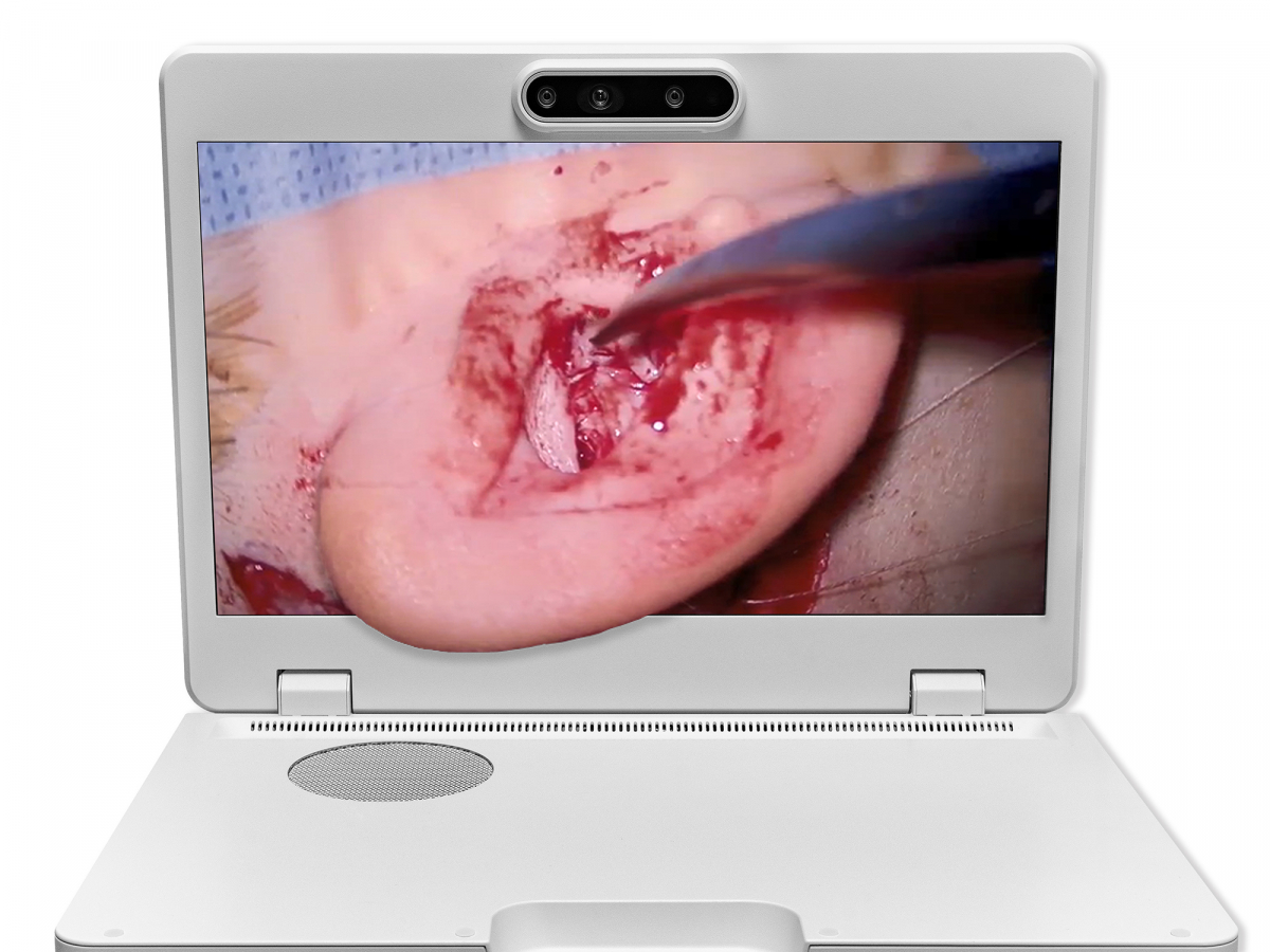 达擎之＂Heads-up 3D显微手术显示系统＂，整合4K裸眼3D显示及眼球追踪系统，具备快速追踪人眼移动位置功能，减轻医师长时间维持固定姿势的负担，让医师能有更宽广清晰的3D立体视野及更舒适的姿势来执行手术。